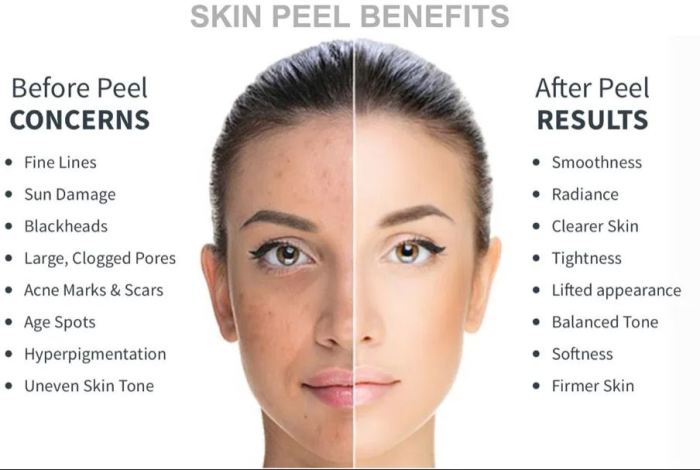 Peels smoother improved hydrated